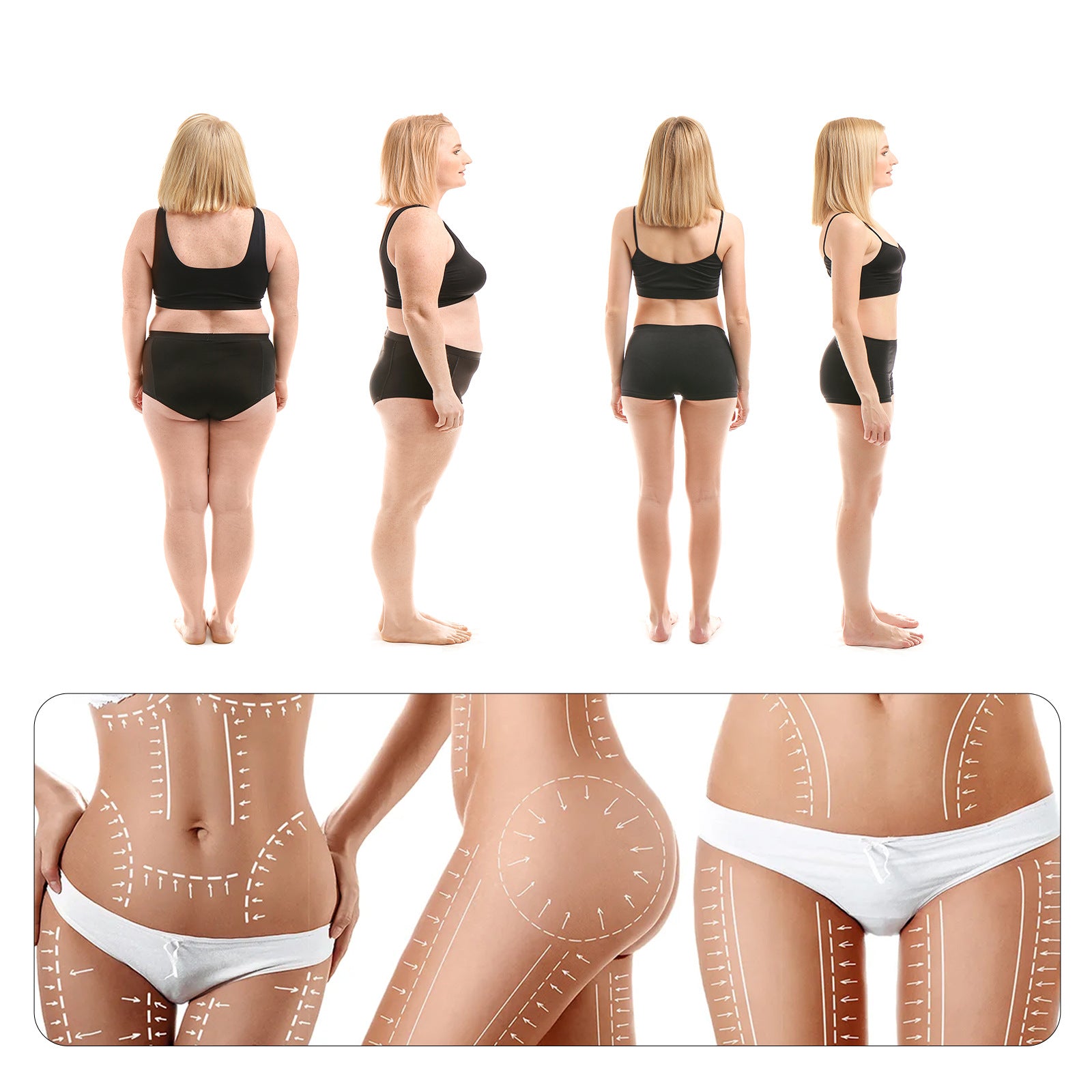 Skin Roller Massage Treatment Moisturizing Thigh Roll-On