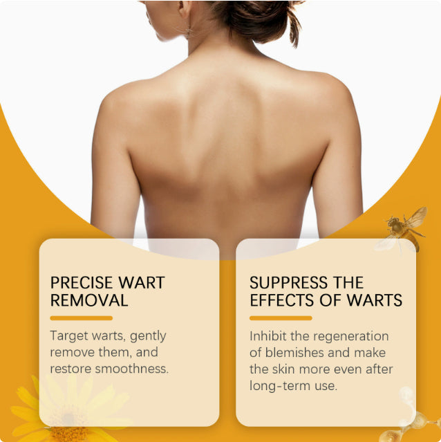 Mole And Wart Treatment Serum Clear And Smooth Skin